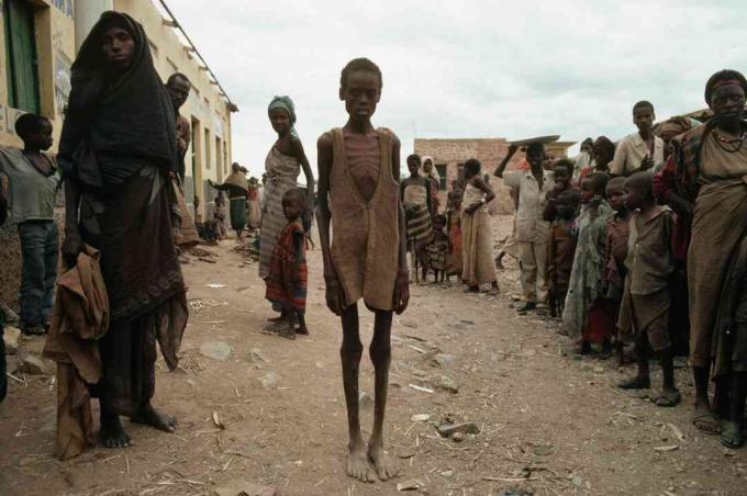A szomáliai polgárháború okozta éhínség áldozatai.